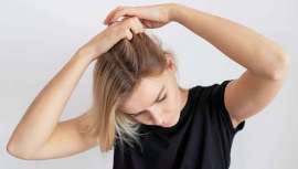 La caspa es una acumulación de escamas blancas en el cuero cabelludo, motivo de incomodidad y vergüenza social en muchas ocasiones, y que en otoño, además, se acentúa 