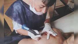 ¿Cómo es el trabajo de reconstrucción de areola en pacientes con cáncer de mama? Berta Valenciano nos lo cuenta 