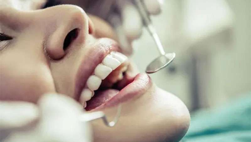 Implantes dentales, un modo de rejuvenecer