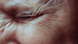 Una nueva investigación ha revelado qué estados están más preocupados por los signos del envejecimiento y cuáles están más interesados en prevenir o reducir las arrugas