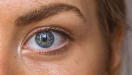 Ana Santamarina, experta en dermocosmética y formulación, explica qué provoca su distinta tonalidad y, sobre todo, cómo se pueden atenuar