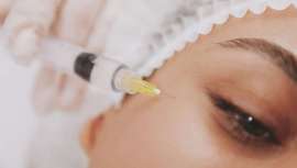 Infiltrar en planos profundos, usar ácido hialurónico sin proyección ni captación de agua, trabajar en el reborde orbital y el uso de cánula, son algunos de los secretos para un resultado perfecto 