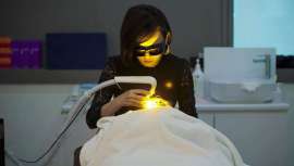 QuadroStar Pro Yellow®, de Asclepion Laser Technologies, con longitud de onda amarilla de 577nm, tecnología revolucionaria que trata lesiones vasculares y pigmentarias, cuperosis, arañas vasculares, eritema hemangiomas o verrugas 