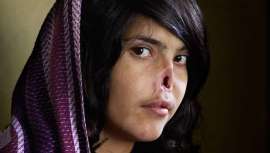 Una intervención devuelve la sonrisa a la afgana mutilada por su marido, cuyo caso fue portada de revistas y conmovió al mundo