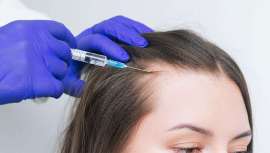 Junto a las alteraciones de la piel, caso del acné y la rosácea, nuevas tendencias en la consulta de Medicina Estética