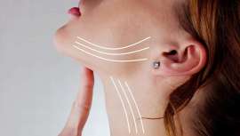 Imposible no tratar el cuello si de lo que se trata es de rejuvenecer. La Dra. Elena Moreno te propone estos tratamientos con los que acabar con la flacidez y las arrugas del cuello