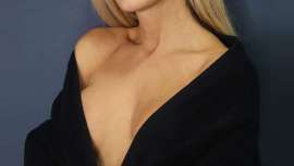 Se trata de una intervención ambulatoria que eleva las mamas, sin aumentar su tamaño ni modificar su forma y sin dejar cicatriz alguna