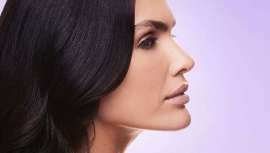 Se dice que la actriz se sometió a una cirugía ortognática -un 
procedimiento maxilofacial para corregir la posición de los huesos 
de la mandíbula- antes de meterse en la piel de Barbie. ¿Era necesario?