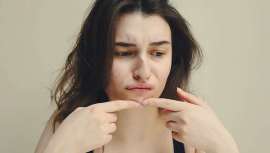 Muchas personas no pueden evitar el tocarse la piel, los granitos y acabar empeorándola y dejando marcas difíciles de eliminar. Podría tener dermatilomanía. Dra. Arantxa Arana nos lo explica