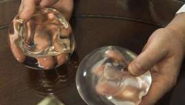 La Audiencia de Guipúzcoa ha confirmado la condena a dos años de cárcel a un médico que aumentó las mamas a una mujer que quería reducírselas y le dejó los pechos en una situación lamentable tras cuatro operaciones