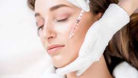 Este tratamiento, los neuromoduladores, ha representado más de un 45% de todos los tratamientos inyectables, incluso más que el ácido hialurónico, siendo el más demandado, invariablemente y con mucha diferencia con respecto al resto, desde 2002