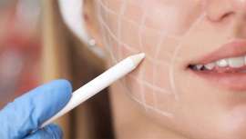 La Dra. Marta Gónzalez, especialista en dermatología médico-quirúrgica en IMR, nos explica el papel clave del colágeno en el envejecimiento de la piel, así como las técnicas más eficaces para estimular su producción