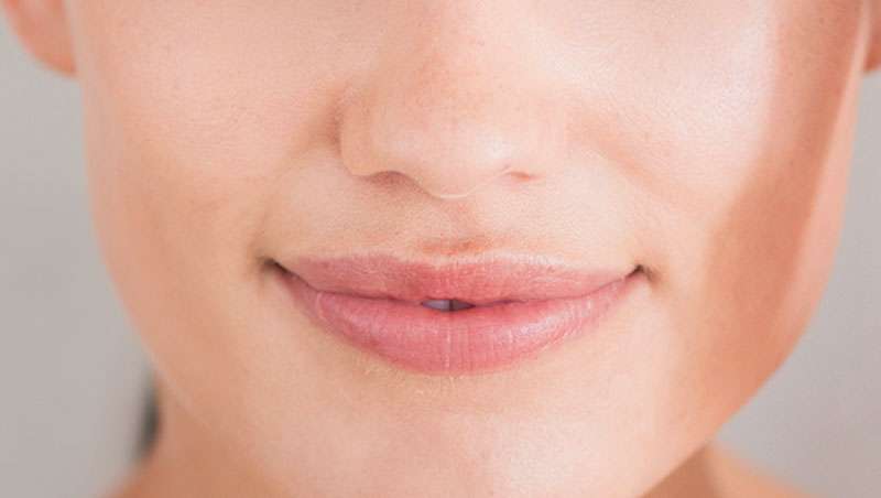 Manchas en el bigote, b�rralas de un plumazo