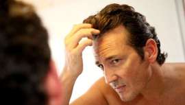 Las especialistas de Quirónsalud Vitoria realizan la técnica F.U.E con pelo natural del propio paciente en un entorno hospitalario seguro. Son ellas mismas quienes nos cuentan por qué la elección de cabello propio