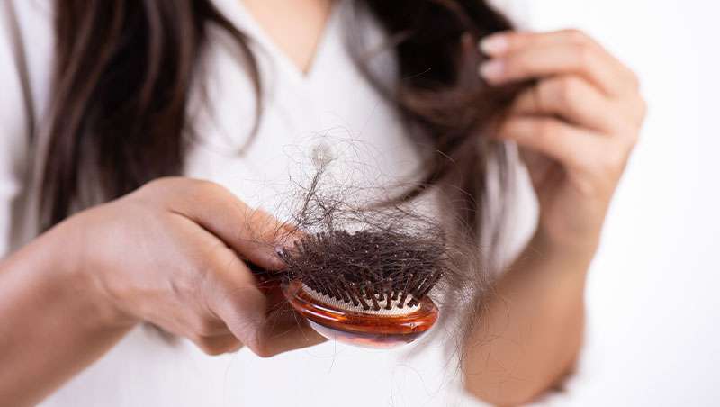 �Sabes la diferencia entre p�rdida de cabello y ca�da capilar? Te lo contamos