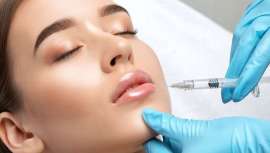 El ácido hialurónico puede salirse del contorno labial provocando un cúmulo de producto en la parte blanca del labio, fuera de lo que es la mucosa labial. Pero puede evitarse al 100% y el doctor Carlos Gómez nos explica cómo