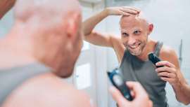 Un estudio acaba de colocar a los españoles en la cima del ranking de calvos en el mundo. Es el país donde más hombres calvos hay por encima de Italia, Francia o Estados Unidos, con casi un 50 por ciento de la población que sufre calvicie