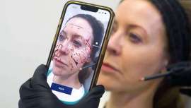 Esta aplicación permite al cirujano tener una aproximación real del mapa arterial de la cara del paciente a pie de cama