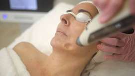 Skinderma Drop, el nuevo tratamiento regenerativo con una infusión de exosomas, que renueva los tejidos, restaura la pérdida de firmeza,  acelera el proceso de autorregeneración y ayuda a darle un impulso de juventud a las propias células