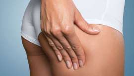 Después de un amplio estudio sobre cuáles son los protocolos que mejor funcionan, en Clínica Mira+Cueto tienen los 4 tratamientos más efectivos para eliminar la celulitis a través de las infiltraciones. ¿Quieres saber cuáles son?