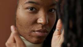 A pesar de constituir más de la mitad de la población mundial, las pieles oscuras, clasificadas como fototipos 4, 5 y 6 según Thomas Fitzpatrick, siguen siendo desatendidas en la formulación y desarrollo de productos para el cuidado de la piel