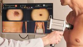 El SkinData, el exhaustivo informe realizado por IMR que analiza anualmente el estado de la piel en España, revela que solo el 25% de los españoles utiliza fotoprotección a diario. Catalanes, andaluces y vascos son sin duda los más concienciados