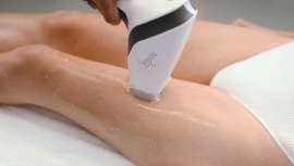 Asclepion presenta este revolucionario protocolo láser diseñado para las pieles con fototipos altos y bronceadas