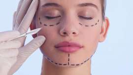 En 2023, los procedimientos de cirugía plástica experimentaron un notable aumento del 5%, superando los 34 millones a nivel global según el informe de la Isaps compartido por la Aecep