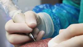 Los profesionales del Grupo Insparya ofrecen los sistemas de trasplante más innovadores e incluso el propio Método Insparya, que garantiza el análisis más minucioso y el trasplante de unas 4 mil unidades foliculares en un solo día