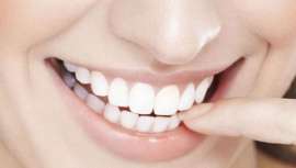 La obsesión por conseguir unos dientes más blancos conlleva ciertos peligros