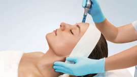 Montibello evoluciona el microneedling con SkinExpert Advance para ofrecer un tratamiento más seguro, menos invasivo y más eficaz