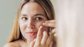 Con la llegada del otoño, Cutibacterium acnes, la bacteria responsable del acné, se activa debido al frío y la humedad, provocando brotes más intensos. Cristina Galmiche nos revela las claves para combatirla