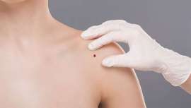 Durante la XXXV Reunión del GEDET en Valencia, se presenta el primer Barómetro de la Dermatología Estética en España, coordinado por el Dr. Miguel Sánchez Viera