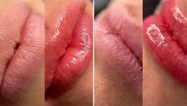 Glossyps® pone el acento en el cuidado labial sin aumento de volumen, basado en el revolucionario protocolo Hydralips, pionero en España gracias a Blanco