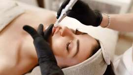 Descubre cómo MicroPuncture Lab, de Noelia Jiménez, combate los estragos del invierno regenerando tu piel desde la primera sesión