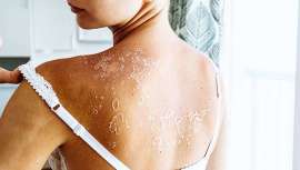 El experto en el cuidado de la piel Jerónimo Ors recomienda adaptar la rutina cosmética durante y después de un tratamiento oncológico