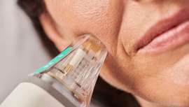 Toxina botulínica y estimuladores de colágeno tienen en común su capacidad para rejuvenecer el rostro en tiempo récord, pero ¿cuáles son sus aplicaciones, resultados y particularidades?