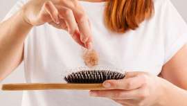 ¿Por qué se acentúa la caída del pelo en primavera? Una farmacéutica lo explica