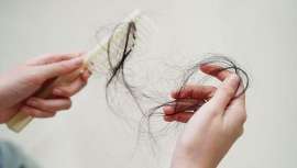 Aunque científicamente no existe una relación directa, para evitar la posible caída del cabello por efectos secundarios de la píldora anticonceptiva se podría recomendar plasma rico en plaquetas y minoxidil