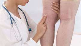 Con este avance, los pacientes que sufren esta patología cuentan hoy con alternativas más seguras, eficaces y confortables para mejorar su calidad de vida