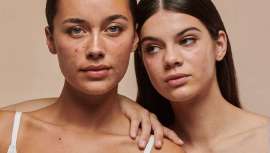 El próximo 6 de junio se celebra el Día Mundial del Acné, una jornada que pone el foco sobre esta afección que afecta a 1 de cada 3 adolescentes, y que tal y como muestra el SkinData 2025 afecta negativamente la autoestima de quien lo padece