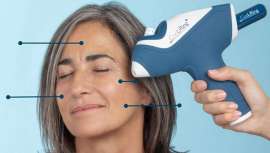 Coolifting celebra 10 años revolucionando la estética con su tecnología de rejuvenecimiento facial. Para agradecerlo, lanza una promoción especial: ¡10 días sin IVA del 1 al 10 de junio!