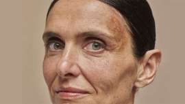 ¿Se pueden revertir los efectos del sol en la piel? Manchas, flacidez y arrugas son solo algunas secuelas del daño solar acumulado. La Dra. Cristina Corredera, dermatóloga de IMR, nos da las claves para combatirlo con eficacia