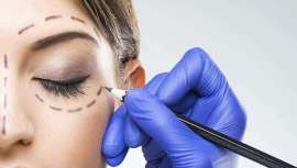 Con su novedoso tratamiento, el Dr. José González Vidal, Director de la Clínica Miestetic, tensa la piel del contorno de ojos haciendo desaparecer las bolsas sin cirugía ni cicatrices