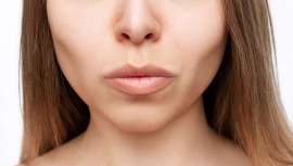 Cuando se experimenta una pérdida de peso repentina, suelen aparecer arrugas y flacidez facial