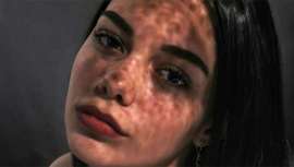 Tras el verano, la piel necesita cuidados específicos para recuperar su vitalidad. El Centro Mem presenta su tratamiento estrella de otoño: el Láser Frío, que devuelve luminosidad, firmeza y uniformidad