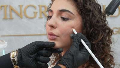 Queen Face®: la técnica del Dr. Zabdiel Chileno que marca tendencia entre las Miss Universo, celebridades y actrices famosas