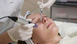 La mesoterapia unida a dispositivos energéticos potencia los resultados estéticos, logrando efectos visibles y duraderos