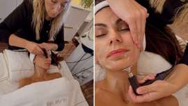 Piel más firme y luminosa, reducción de arrugas y líneas de expresión, son algunos de sus resultados