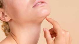 Endoláser de papada: la técnica más top para redefinir tu perfil sin cirugía